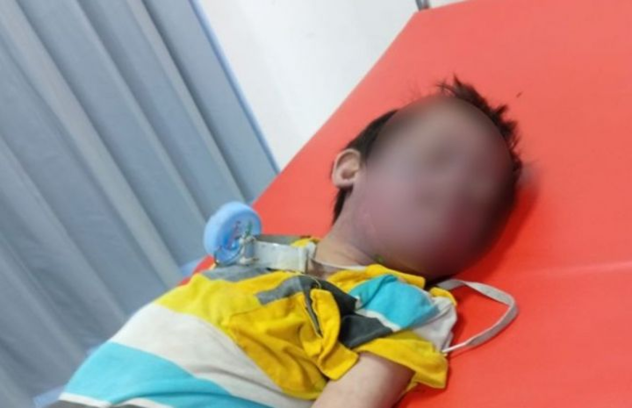 Bocah berusia 10 tahun berinisial Z, penyandang down syndrome, sebelum meninggal. (Dok Keluarga)